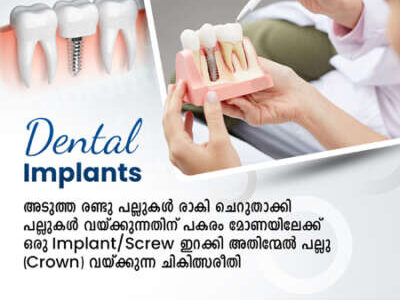 VENUS DENTAL CARE